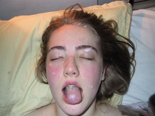 Best Facial Gallery Ever 179