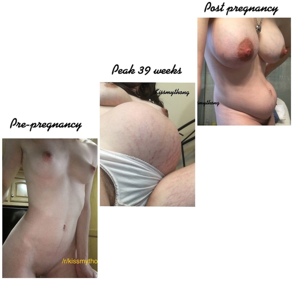  Pregnant Gravidas 15 