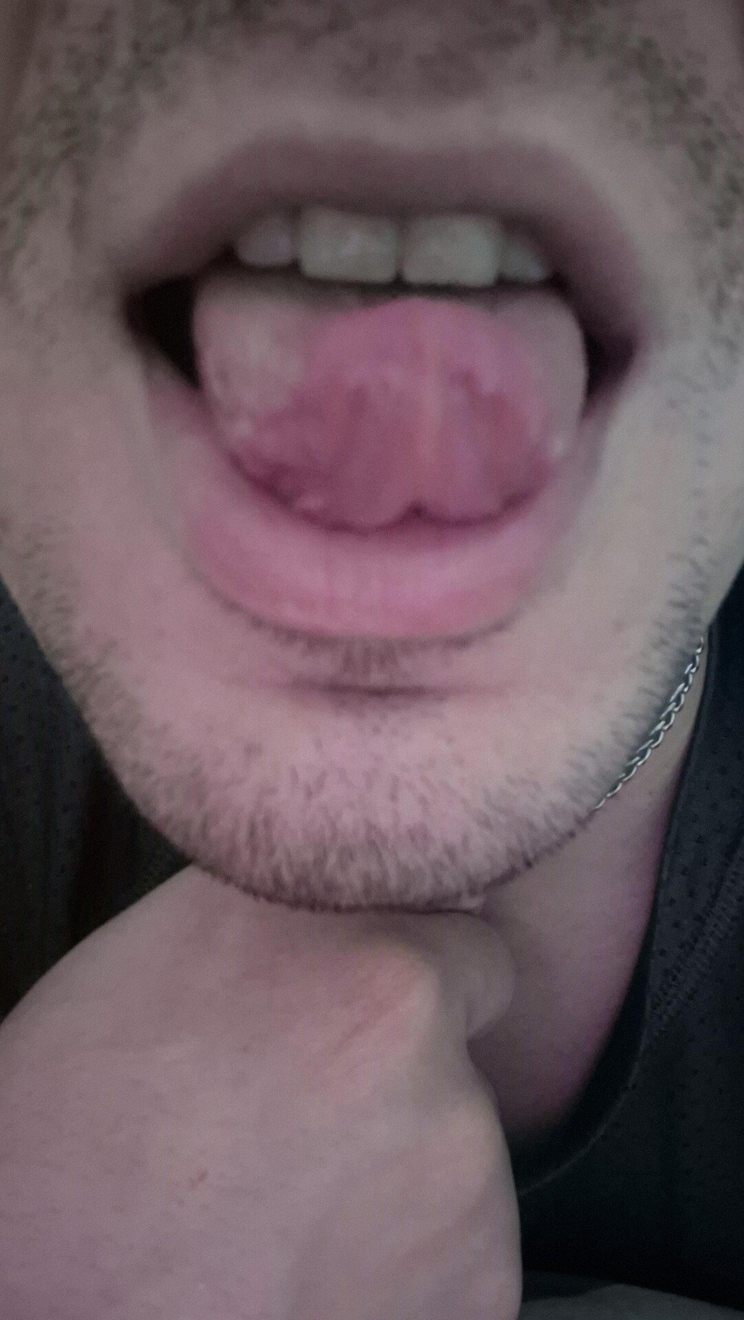 una zorr1 taa 1